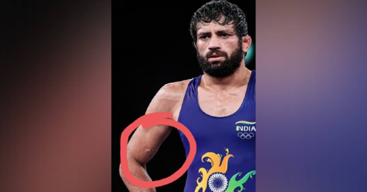 Tokyo Olympics: Nurislam Sanayev bites Ravi Dahiya during semi-final clash, Sehwag labels act 'disgraceful'